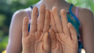 Why Does The Skin Of Your Finger Shrink When You Wash Clothes For A Long Time?